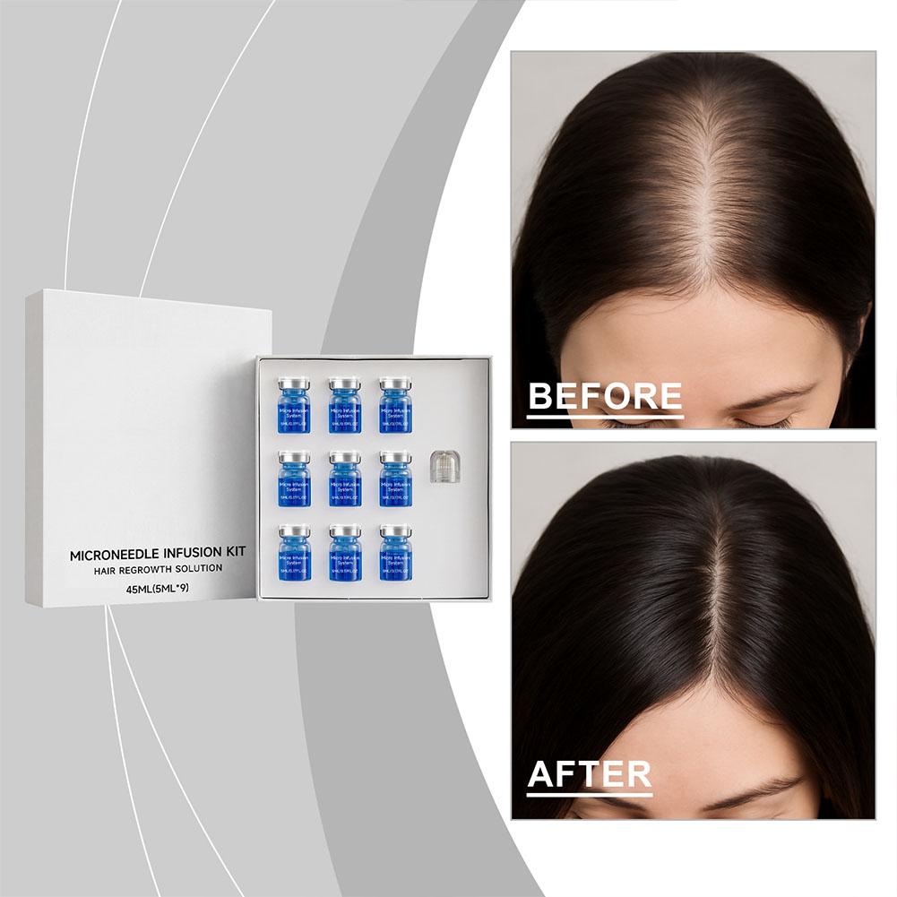 Hair Care Essence Oil - Set de Rodillo de Microagujas con