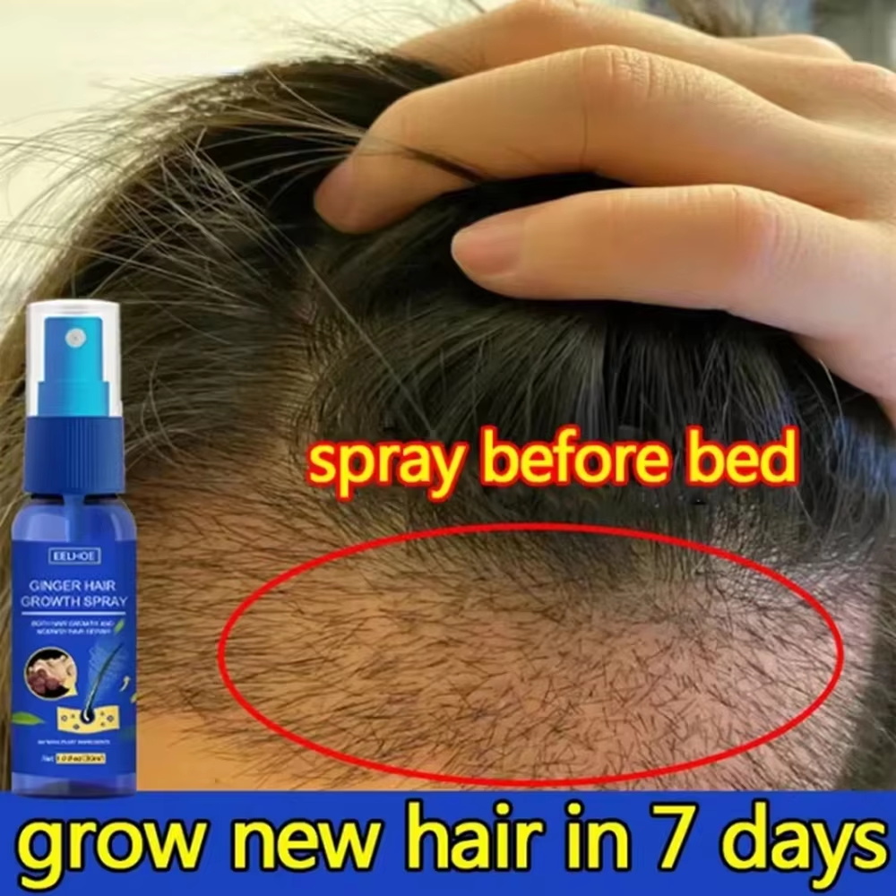 Hair Care Lotion - Spray de Crecimiento Rápido del Cabello