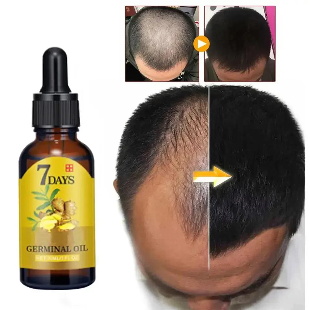Hair Care Essence Oil - Aceite esencial de jengibre para el