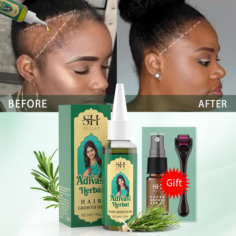 Aceite Ayurvédico para el Crec - Hair Care Essence Oil reseña y precio