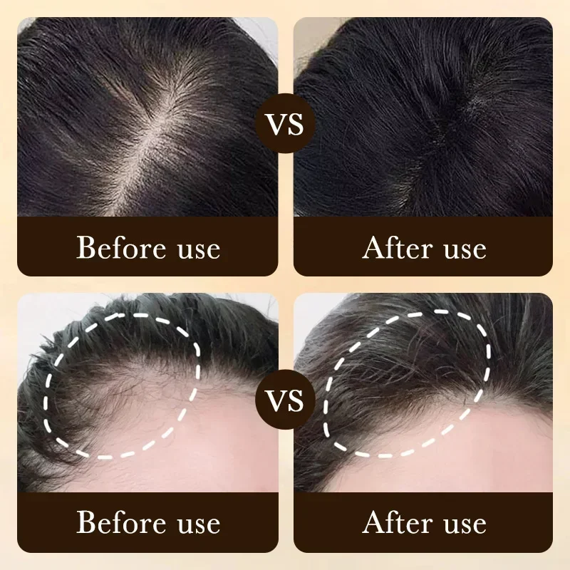 Aceite de Biotina para el Crec - Hair Care Essence Oil reseña y precio
