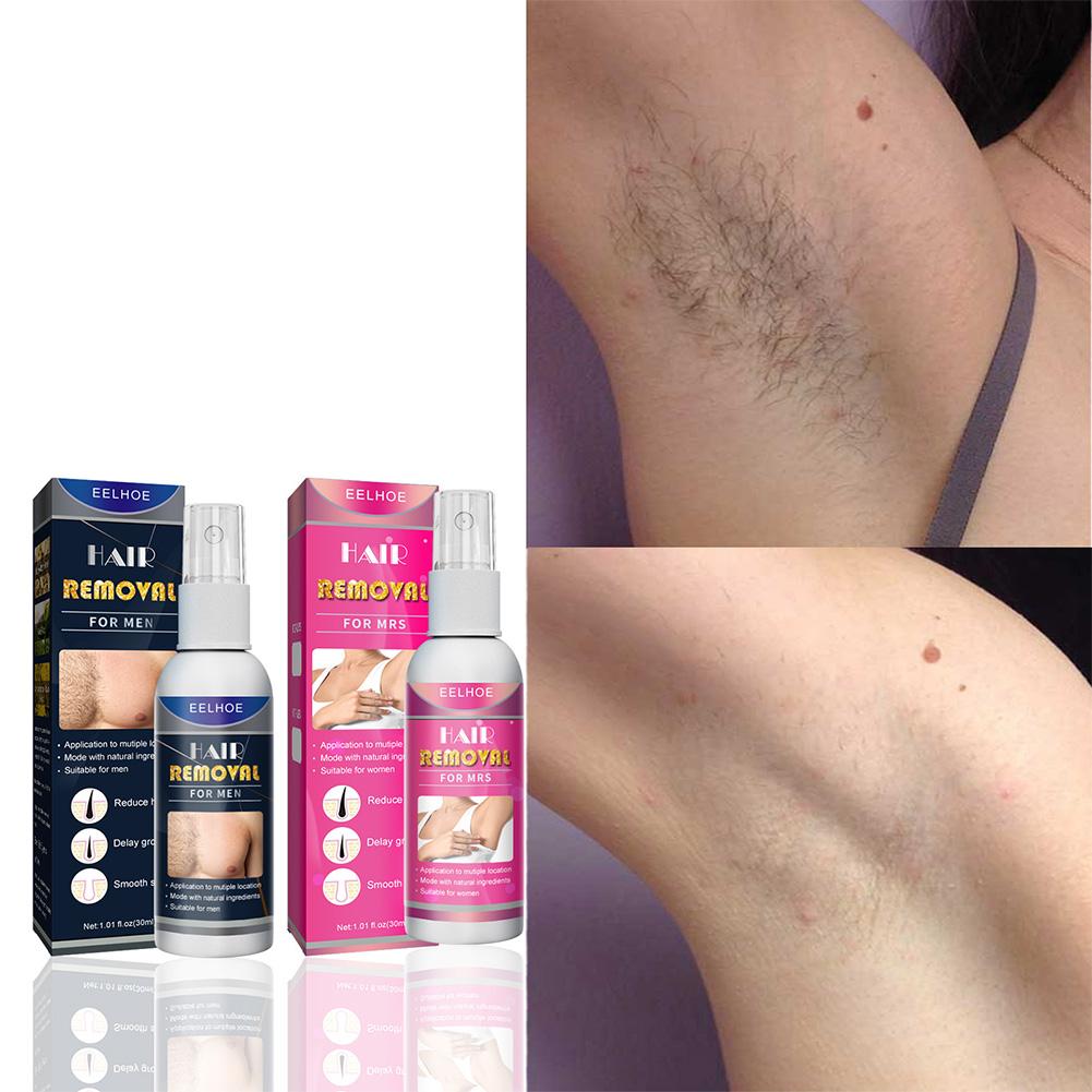 1/2 Uds. Depiladora permanente - Hair Care Lotion reseña y precio